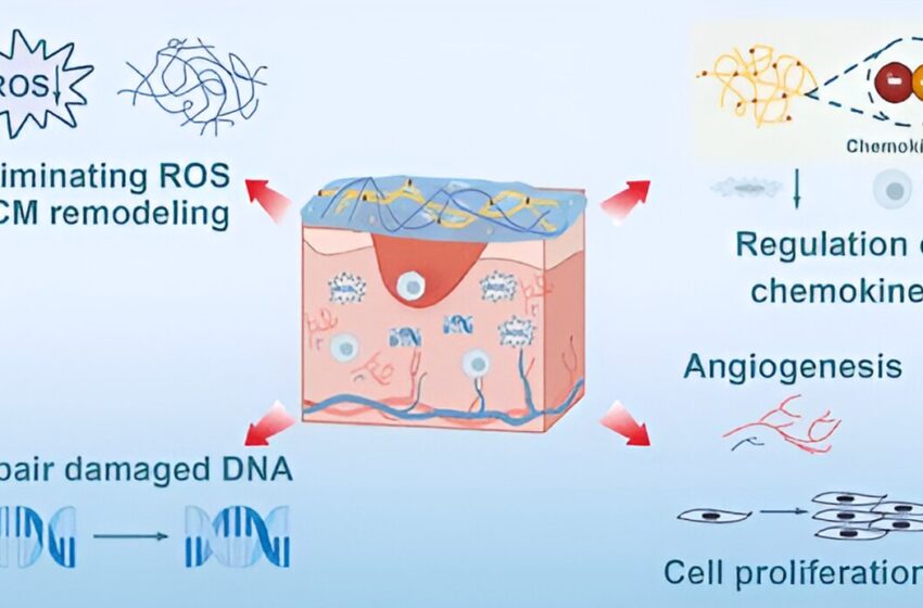  Traitement des plaies dues aux radiations avec des hydrogels d’aspirine