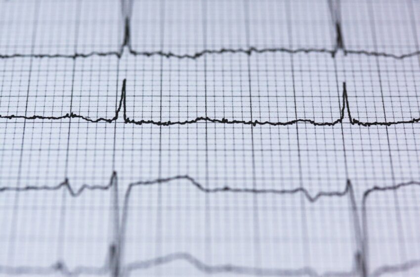  Un nouvel outil d’IA simplifie la surveillance cardiaque : moins de sondes, même précision