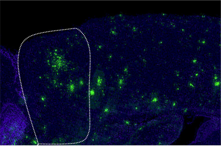  Un traitement à la dopamine soulage les symptômes de la maladie d’Alzheimer