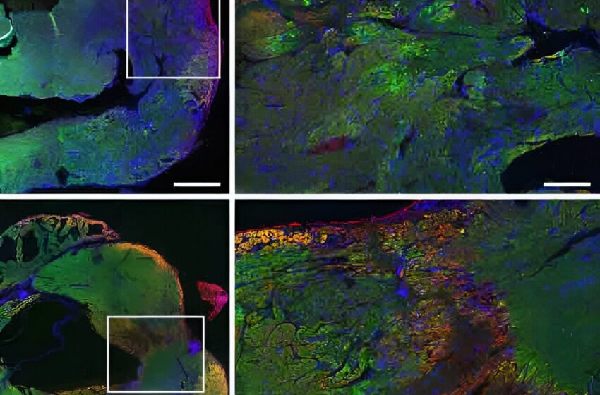  Une équipe de recherche découvre comment Copaxone protège le muscle cardiaque et améliore sa fonction après une crise cardiaque