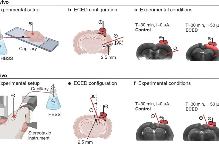  Une étude montre une nouvelle façon plus précise d’administrer des médicaments au cerveau