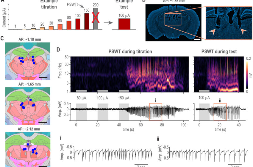  Une étude quantifie le risque de crise en stimulant le thalamus chez des souris éveillées