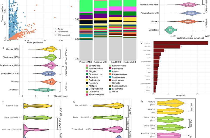  Une étude révèle des causes génétiques jusqu’alors inconnues du cancer colorectal