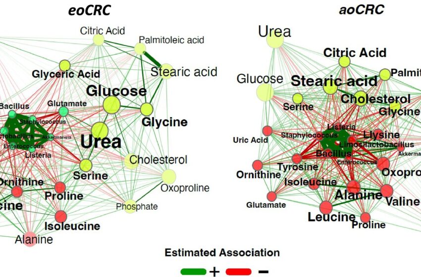  Une étude révèle que l’alimentation est le principal facteur de risque du cancer du côlon chez les jeunes adultes