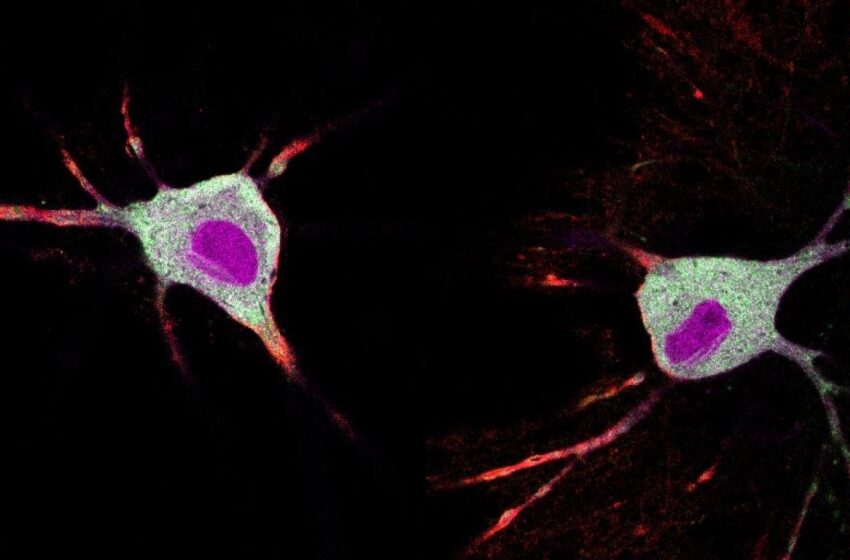  Une nouvelle méthode permet de suivre en quelques minutes l’effet des substances psychédéliques sur les neurones