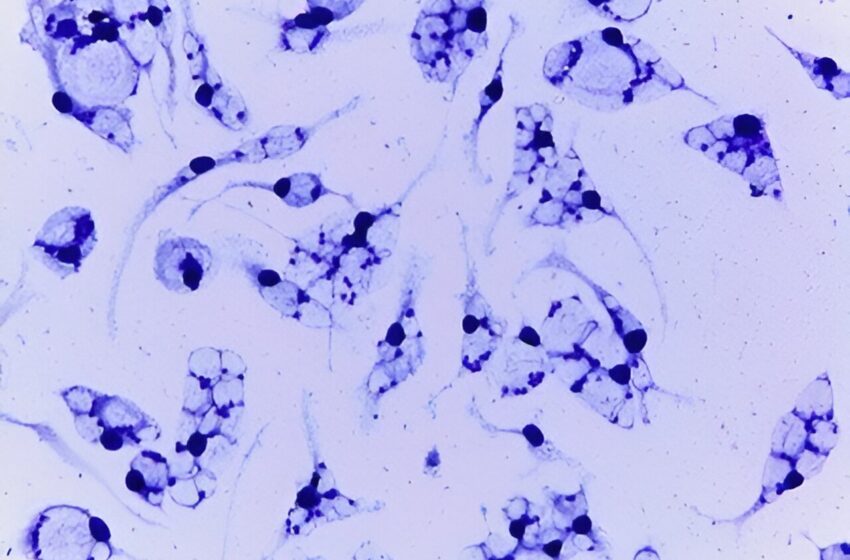  Une souche de Leishmania au Brésil montre une résistance à des médicaments clés