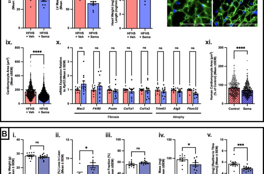  Un médicament amaigrissant réduit le muscle cardiaque chez la souris et les cellules humaines