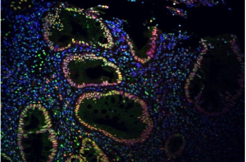  Une nouvelle recherche relie la stimulation du nerf vague à une réduction de l’inflammation intestinale chez la souris