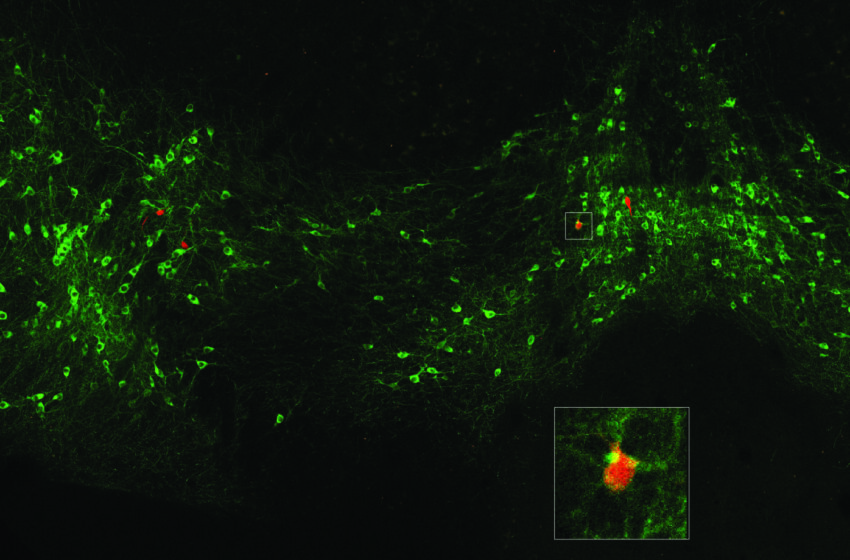  Dopamine signale lorsqu’une peur peut être oubliée, l’étude montre