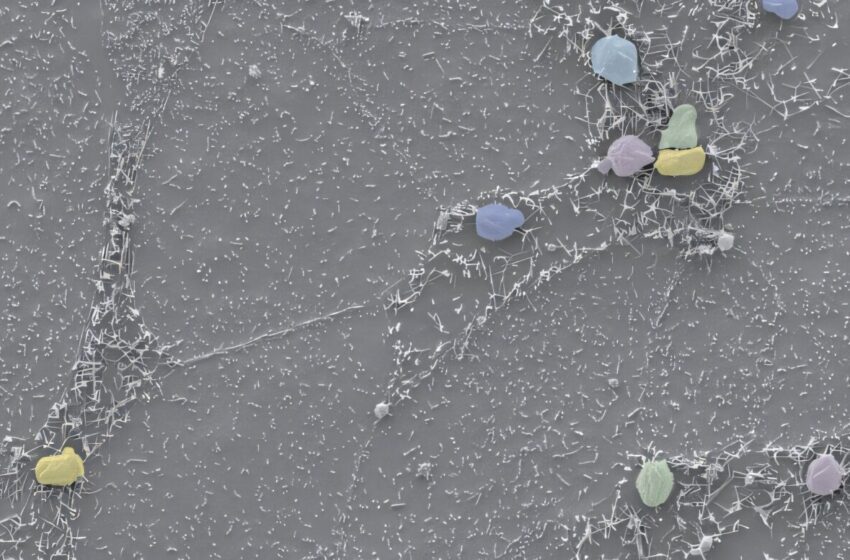  Les chercheurs découvrent comment le parasite intestinal Cryptosporidium modifie les cellules hôtes