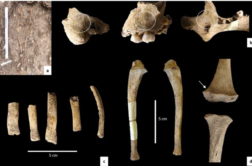  L’étude découvre le traitement au mercure dans l’enfant français du XIXe siècle souffrant de ricotte et de scorbut