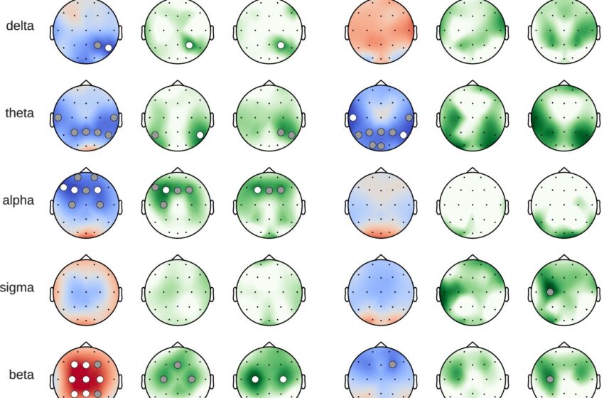  Comment le café affecte un cerveau endormi