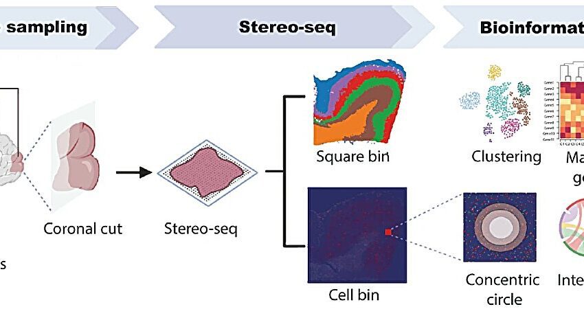  La nouvelle technique de cartographie du cerveau met en lumière le développement d’Alzheimer