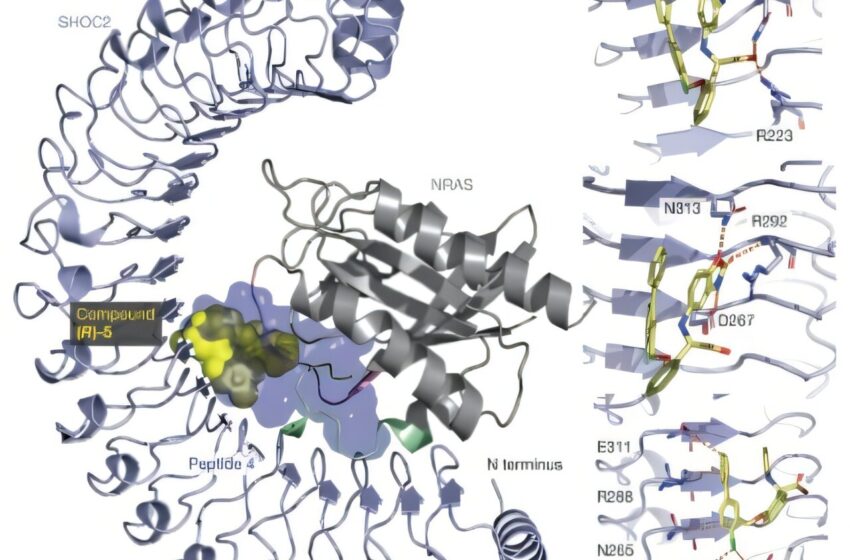  L’écran CRISPR à l’échelle du génome identifie une nouvelle cible dans le mélanome axé sur les NRAS