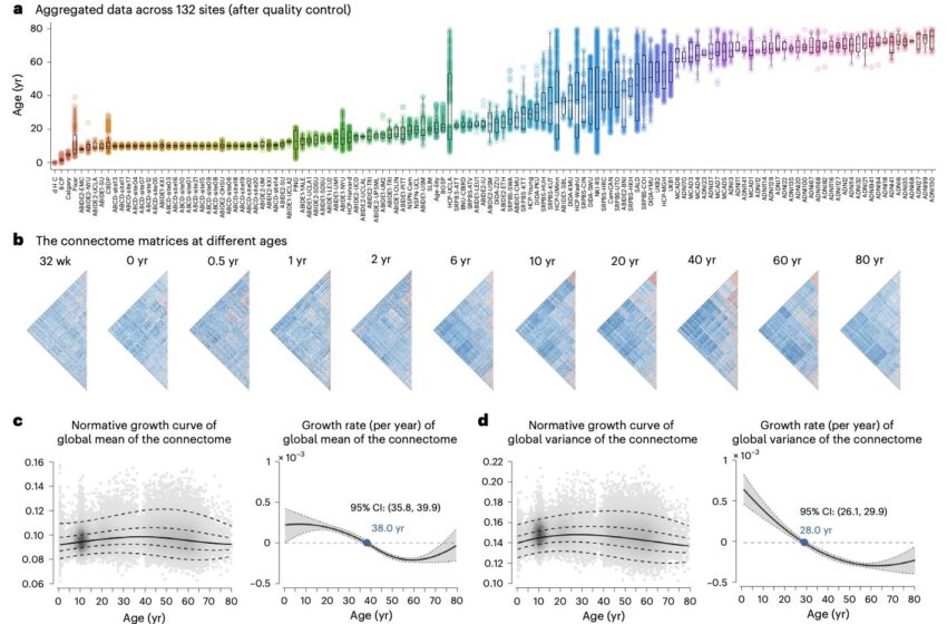  Une étude à grande échelle explore les changements de durée de vie dans la connectivité fonctionnelle du cerveau humain
