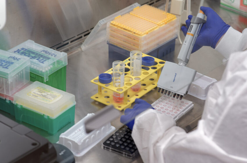  Les cellules souches créées à partir de patients SLA pointent vers une nouvelle cible potentielle pour le traitement