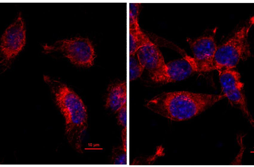  La mutation donne de nouveaux indices pour traiter les tumeurs « froides » immunitaires
