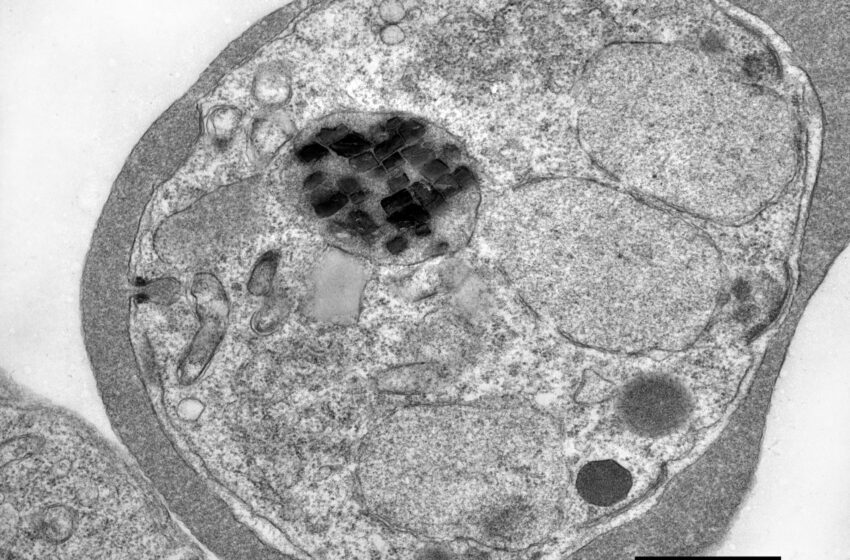  Les parasites du paludisme sont remplis de cristaux de fer en rotation extravagante : les scientifiques savent enfin pourquoi