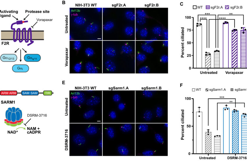  Pathway fournit de nouvelles informations sur la façon dont les cils à la surface des cellules se décomposent avant la division
