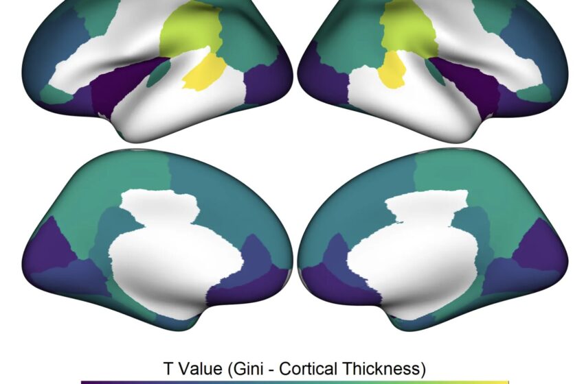  Vivre dans une société inégale a un impact sur la structure du cerveau des enfants, selon une étude