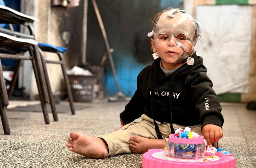  Gaza: 4 000 enfants nécessitent une évacuation médicale, paralysies et malformations en hausse