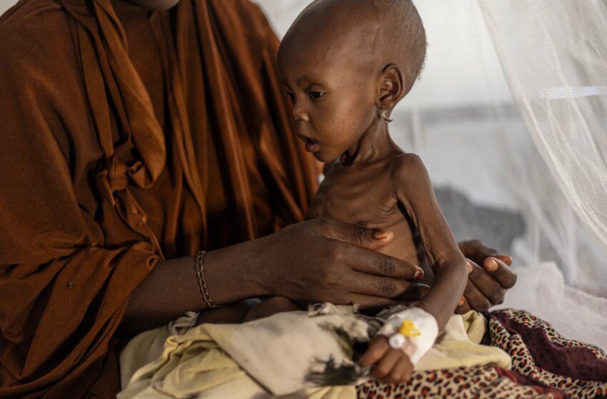  Somalie: sécheresse et réductions d’aide américaines provoquent une crise de malnutrition à Kismayo