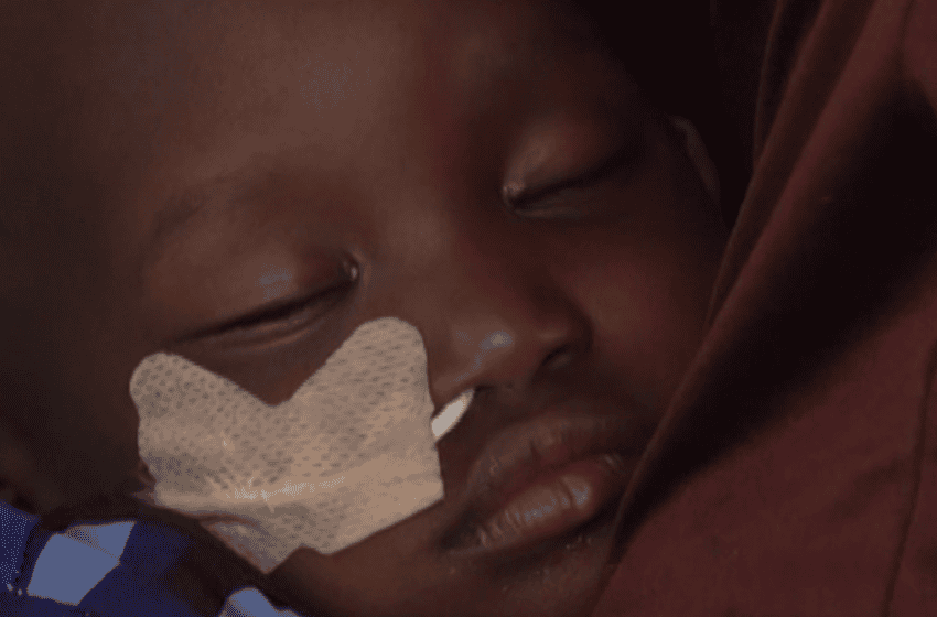  Guerre américaine contre l’Iran : médecins alertent sur l’aggravation de la malnutrition au Nigeria